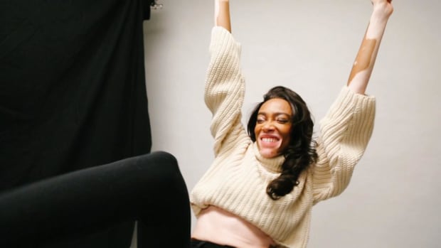 Winnie Harlow Is the Newest Rookie in SI Swimsuit 2019